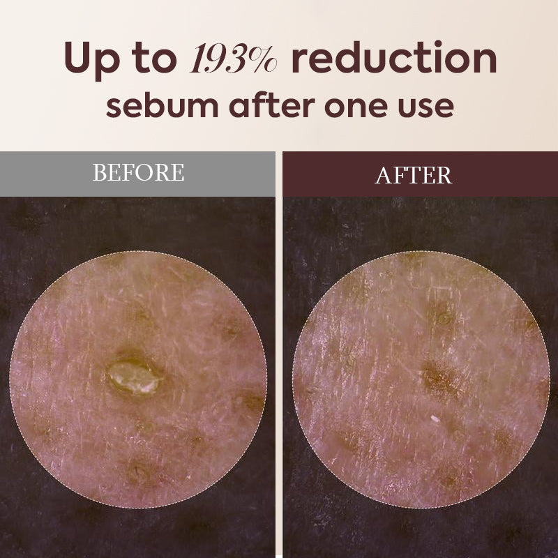 Glowing Rice Ampoule Double Effect Exfoliating Essence🌾