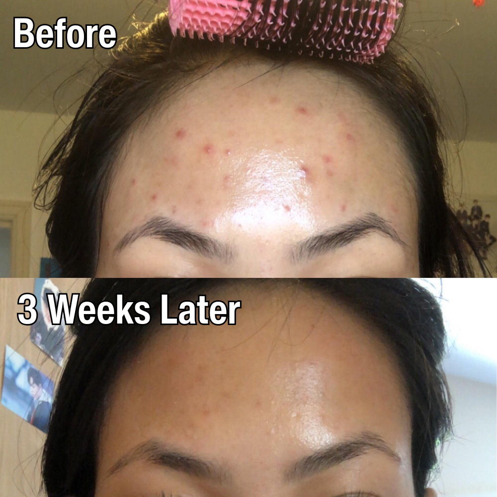 Korean Glycolic Acid Pads (50 Pcs)