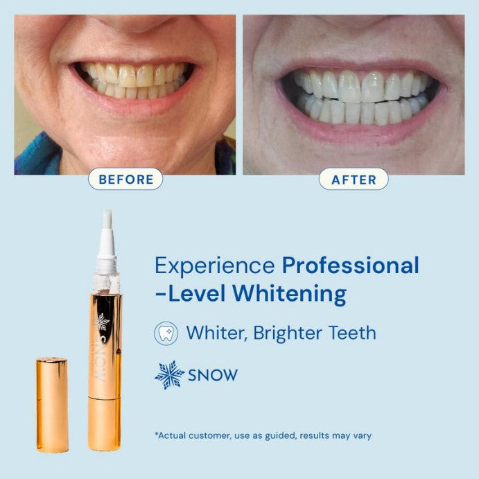 Teeth Whitening Pen