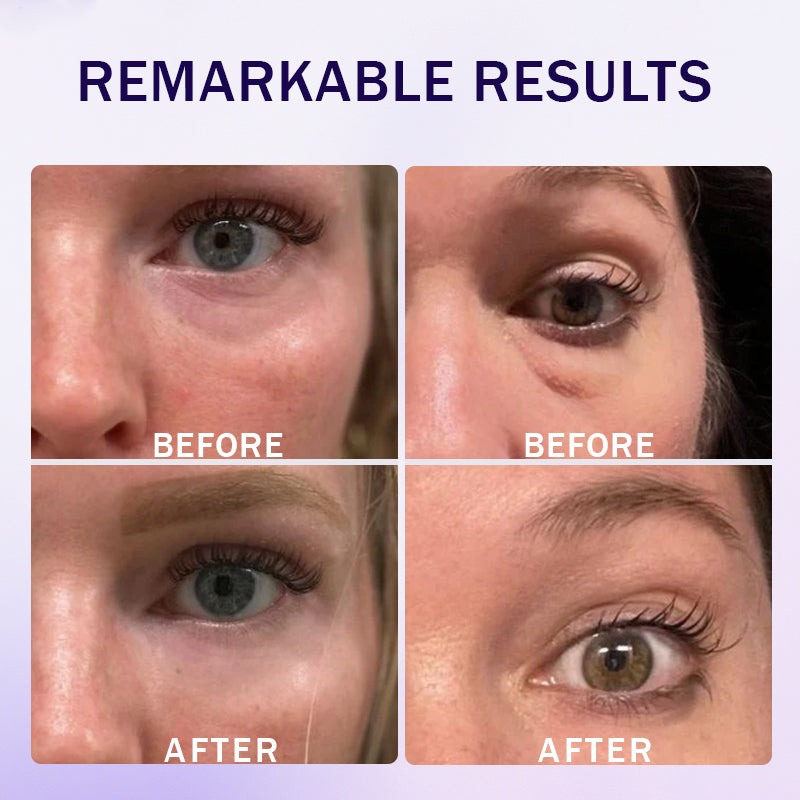 🌸Instant Collagen Infusion Tightening Eye Patches