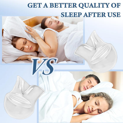 SleepEase Mouthguard