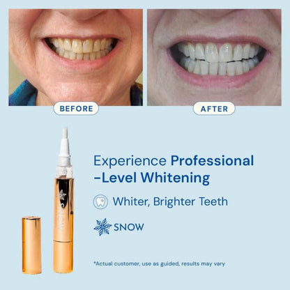 Teeth Whitening Pen